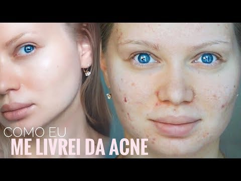 download lagu mp3 mp4 Clindo, download lagu Clindo gratis, unduh video klip Clindo