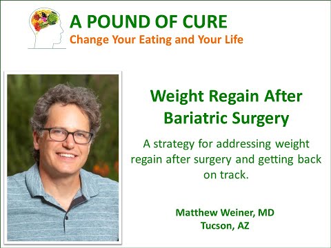 download lagu mp3 mp4 Bariatric Sleeve Reset, download lagu Bariatric Sleeve Reset gratis, unduh video klip Bariatric Sleeve Reset