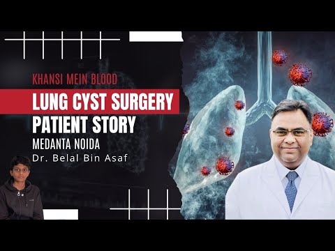Khansi Mein Blood – Lung Cyst Surgery Patient