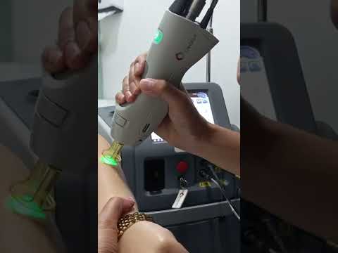 how to use the candela machine for body laser hair...