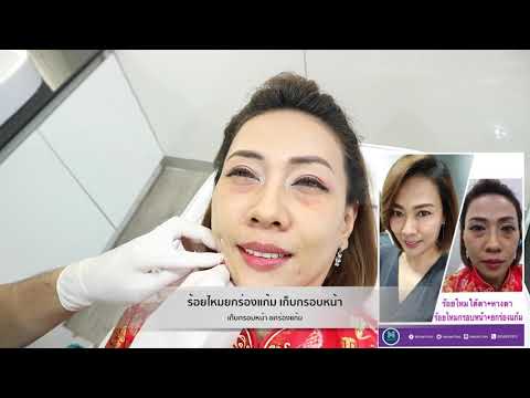 ร้อยไหม หน้าเรียว