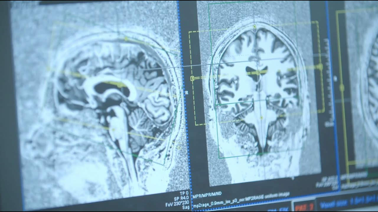 The Psychedelic Renaissance - from drug to medicine? (full documentary)