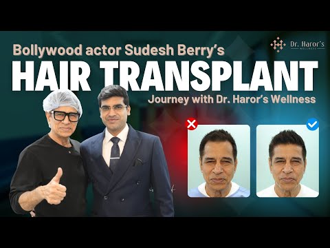 Hair Transplant Procedure Explained