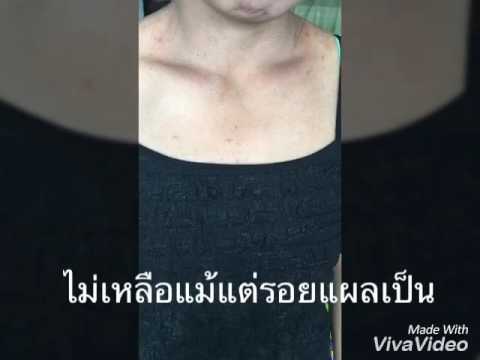หน้าอกเล็กที่ฮอร์โมนเพศชายสูง ความคิดเห็นของครีมเพื่อเพิ่มความคิดเห็นหน้าอก Eveline