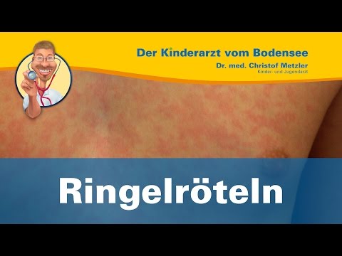 Ringelröteln - Der Kinderarzt vom Bodensee