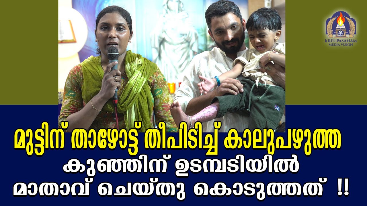 മുട്ടിന് താഴോട്ട് തീപിടിച്ച് കാലുപഴുത്ത കുഞ്ഞിന് ഉടമ്പടിയിൽ മാതാവ് ചെയ്തു കൊടുത്തത്!!