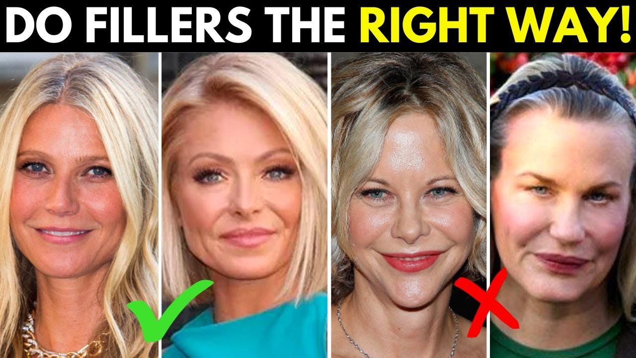 The Right and Wrong way to use fillers for anti-aging