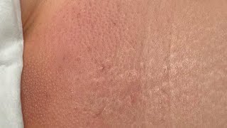 Download lagu Brazilian waxing tutorial #brazilianwax #bikiniwax mp3