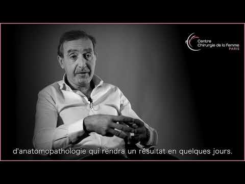 La biopsie dans le diagnostic du cancer du sein - Dr Eric Sebban