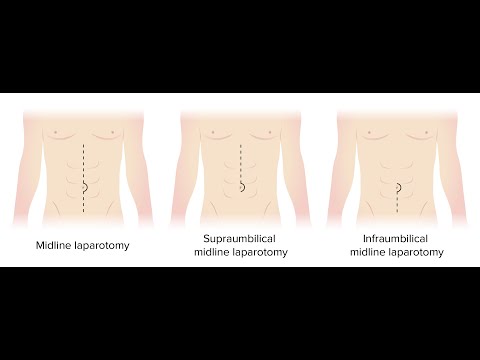 Cpt Code For Diagnostic Laparotomy