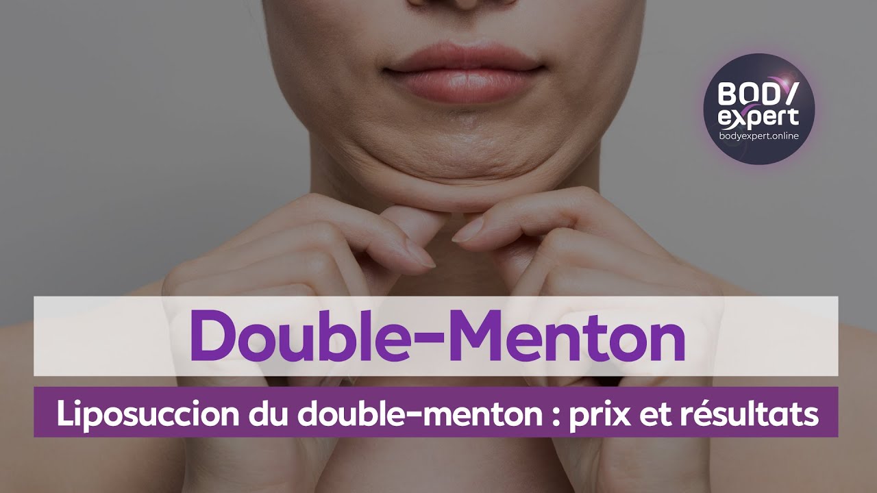 CHIRURGIE ESTHÉTIQUE  | 🙋🏻‍♀️Liposuccion du double-menton : prix et résultats | BODYEXPERT