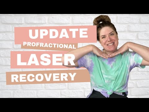 TWO MONTH: Post Profractional Laser Update