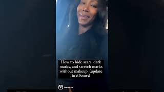 Black woman spray tan! I love it. Helps to hide scars, stretch marks and gives an even glow