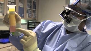 Adivive Fat Transfer System