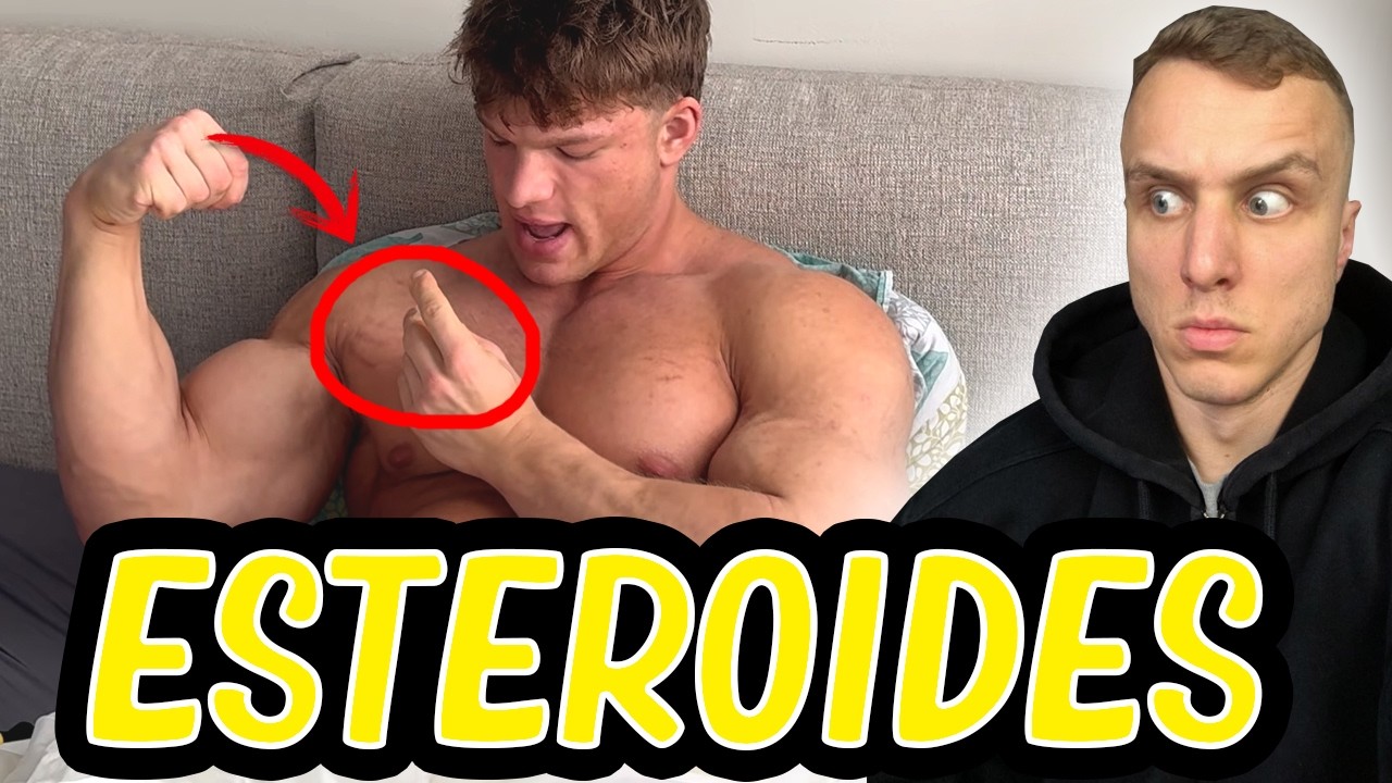 Se ha perdido el respeto por la química en el culturismo *se pincha en la calle*