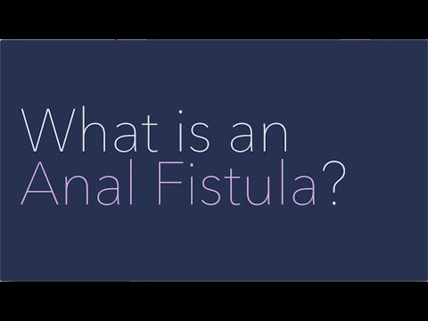 What Is an Anal Fistula?