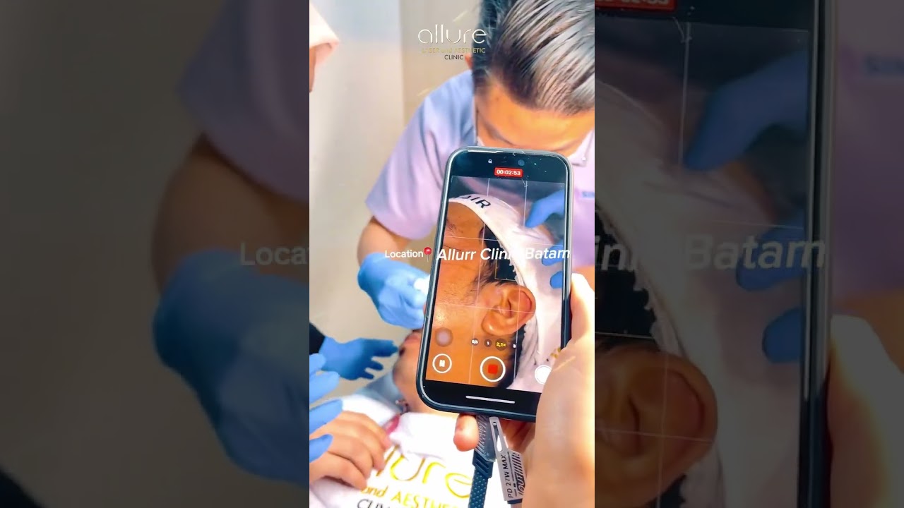 Elevasi Standar Estetika Menguasai Seni Stimulasi Kolagen Melalui Private Workshop Ellanse