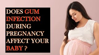 Gum infection during pregnancy/  preterm babies/pregnancy gingivitis