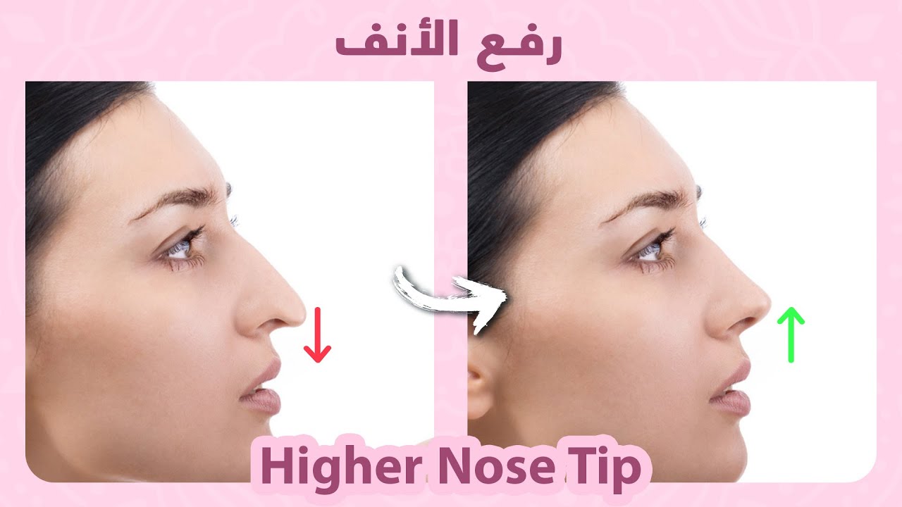 How to naturally lift our nose