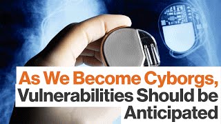 Hackers Will Be Tempted by Cyborg Vulnerabilities