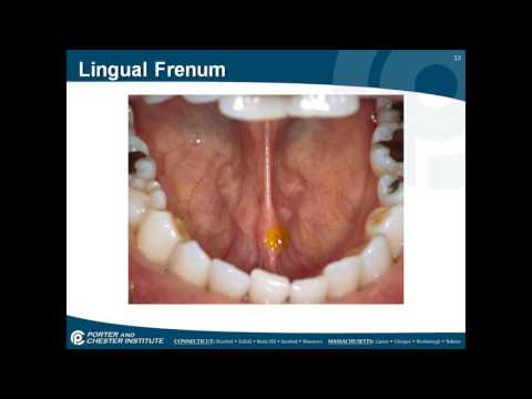 Landmarks of the oral cavity