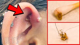 CLEAN Your Piercings Or THIS Can Happen…*REMOVAL*