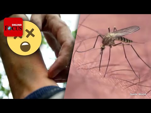 Blauer Fleck nach Insektenstich: Was Sie gegen die ekligen Bisse tun können