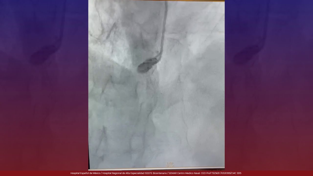 Marcelo Utrera Lagunas-116