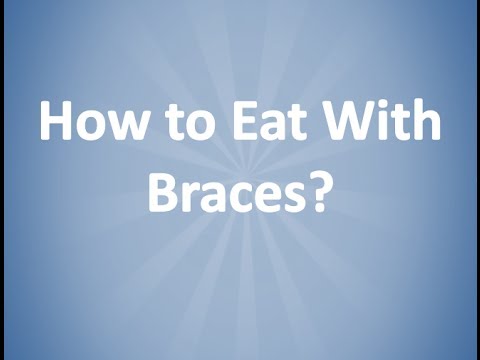 How to Eat With Braces - Orthodontist - Winter Springs, FL