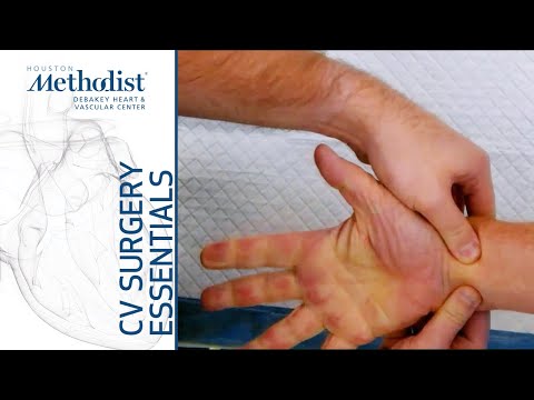 How to Perform an Allen Test (Alan B. Lumsden, MD, Cara Chasin, MD)