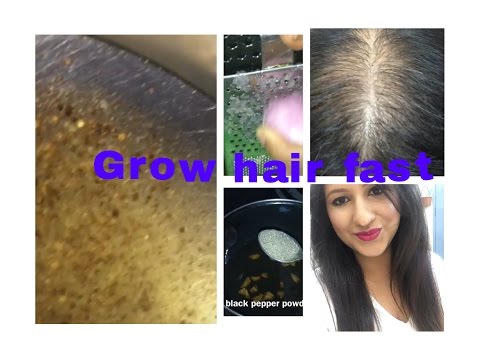 Best home remedy for Hair Regrowth for bald hair patches ( not for PITTA DOSHA) Video