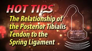 The Relationship of the Posterior Tibialis Tendon to the Spring Ligament