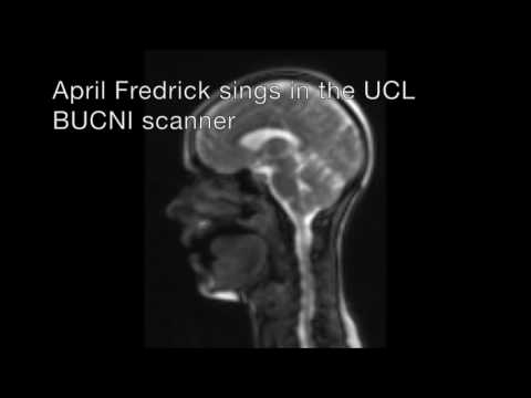 April Fredrick singing in the BUCNI scanner - dynamic MRI