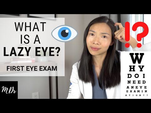 Does your child have a LAZY EYE??! | Types, Causes & Effects Explained