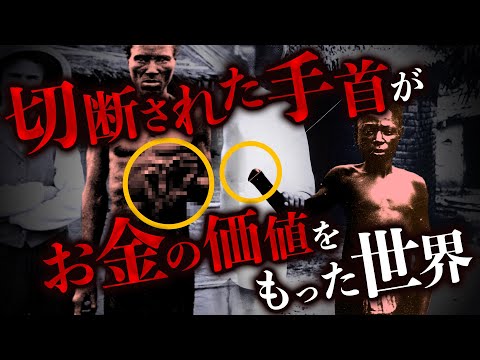 ヨーロッパとアフリカの免疫システム