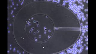 neutrophil vs. Staph : neutrophils win