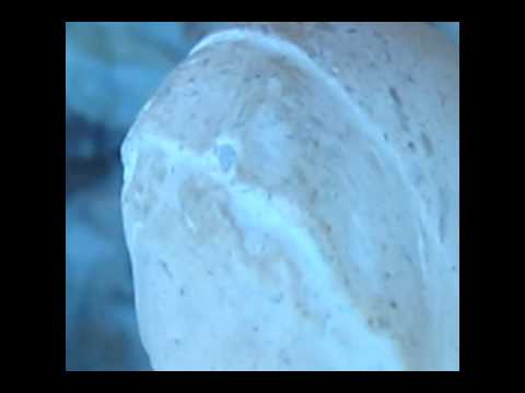 La decolorazione di crema da posti pigmentary di un belit vitex Le lentiggini di naso come liberarsi