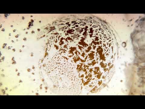 LUNG CHANNEL/MERIDIAN SYSTEM RESONANCE (TCM) | MAGNETO - DIELECTRIC ( SCALAR ) FIELDS