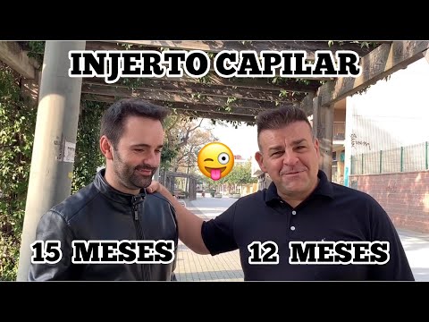 Injerto capilar VAStube y Flequi