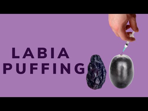 Labia Puffing in Los Angeles, Glendale | Dr. Michael Tahery