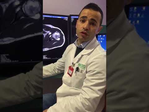 Trattamento di osteocondrosi il video Gitt Acido acetilsalicilico con dolore al collo