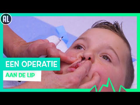 JOHNNY HEEFT EEN SCHISIS 👄 | TOPDOKS OPERATIEKAMER