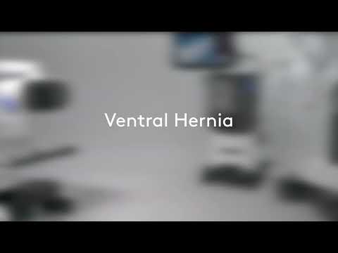 Ventral Hernia Repair with Da Vinci Robot | Dallas Mind & Body