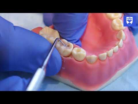 A Technique For Atraumatic Restorative Treatment (ART). Part 1: Cavity Preparation