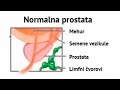 Pro Caps Bosna I Hercegovina BA Profesionalni Tretman Za Prostatitis