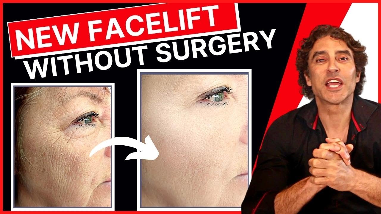 Watch video NEW PROCEDURE Facelift WITHOUT Surgery 🔥 Ellacor Micro Coring Now NEW PROCEDURE Facelift WITHOUT Surgery 🔥 Ellacor Micro Coring