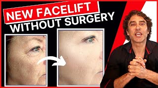 NEW PROCEDURE Facelift WITHOUT Surgery 🔥 Ellacor Micro Coring