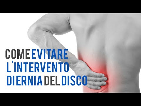 Artrosi delle articolazioni delle dita dei piedi Applicatore magnitoelastichny per ginocchio recensioni congiunte