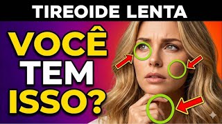 9 SINAIS PERIGOSOS de HIPOTIREOIDISMO (A maioria ignora o #2)
