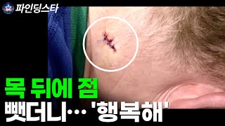 아이스하키 경기 중 발견한 목 뒤의 점, 인생이 바뀌었다